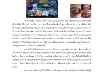 เตือนภัย จัดฟันแฟชั่น อันตรายถึงชีวิต